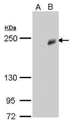 TET3 Antibody in Western Blot (WB)