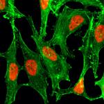 H2BK23ac Antibody in Immunocytochemistry (ICC/IF)