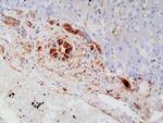 GSTP1 Antibody in Immunohistochemistry (Paraffin) (IHC (P))