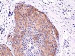 Phospho-Acetyl-CoA Carboxylase (Ser79) Antibody in Immunohistochemistry (Paraffin) (IHC (P))