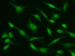 ASF1B Antibody in Immunocytochemistry (ICC/IF)