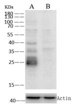 Cathepsin L Antibody in Western Blot (WB)