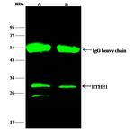 ETHE1 Antibody in Immunoprecipitation (IP)