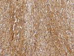 GSTM2 Antibody in Immunohistochemistry (Paraffin) (IHC (P))