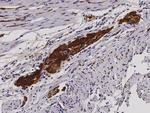 CD171 Antibody in Immunohistochemistry (Paraffin) (IHC (P))