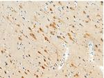 JNK2 Antibody in Immunohistochemistry (Paraffin) (IHC (P))