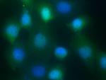 S100A9 Antibody in Immunocytochemistry (ICC/IF)