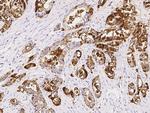 TSPAN1 Antibody in Immunohistochemistry (Paraffin) (IHC (P))