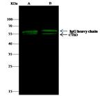 Cathepsin D Antibody in Immunoprecipitation (IP)