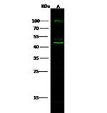 Cathepsin D Antibody in Western Blot (WB)