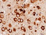 RAP Antibody in Immunohistochemistry (Paraffin) (IHC (P))