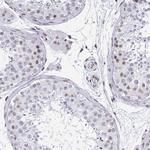 CTCF Antibody in Immunohistochemistry (Paraffin) (IHC (P))