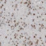 Dicer Antibody in Immunohistochemistry (Paraffin) (IHC (P))