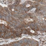 Dicer Antibody in Immunohistochemistry (Paraffin) (IHC (P))