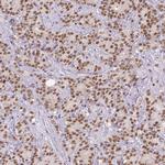 ERCC1 Antibody in Immunohistochemistry (Paraffin) (IHC (P))