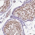 ERCC1 Antibody in Immunohistochemistry (Paraffin) (IHC (P))