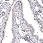 FOXP2 Antibody in Immunohistochemistry (Paraffin) (IHC (P))