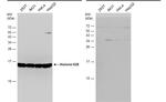 Histone H2B Antibody in Western Blot (WB)