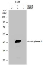 Arginase 1 Antibody in Western Blot (WB)