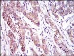 MRP4 Antibody in Immunohistochemistry (Paraffin) (IHC (P))