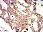 APC2 Antibody in Immunohistochemistry (Paraffin) (IHC (P))