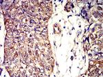 APC2 Antibody in Immunohistochemistry (Paraffin) (IHC (P))