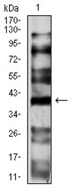 CCR1 Antibody in Western Blot (WB)