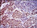 CLGN Antibody in Immunohistochemistry (Paraffin) (IHC (P))