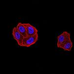 DDX1 Antibody in Immunocytochemistry (ICC/IF)