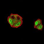 DDX1 Antibody in Immunocytochemistry (ICC/IF)