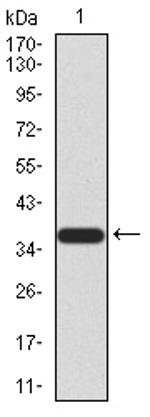 FBXL10 Antibody in Western Blot (WB)