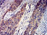 GRIK4 Antibody in Immunohistochemistry (Paraffin) (IHC (P))