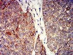 GRIK4 Antibody in Immunohistochemistry (Paraffin) (IHC (P))