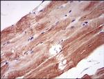 NPC1 Antibody in Immunohistochemistry (Paraffin) (IHC (P))