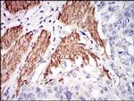 NPC1 Antibody in Immunohistochemistry (Paraffin) (IHC (P))