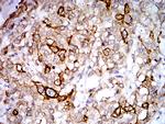 PGRMC1 Antibody in Immunohistochemistry (Paraffin) (IHC (P))