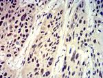 Phospho-4EBP1 (Ser65) Antibody in Immunohistochemistry (Paraffin) (IHC (P))