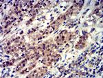 Phospho-4EBP1 (Ser65) Antibody in Immunohistochemistry (Paraffin) (IHC (P))