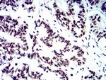 SMARCA1 Antibody in Immunohistochemistry (Paraffin) (IHC (P))