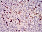 WASP Antibody in Immunohistochemistry (Paraffin) (IHC (P))