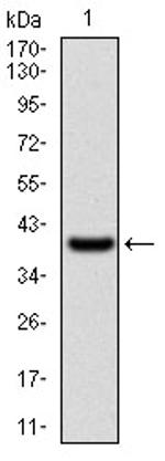 WASP Antibody in Western Blot (WB)