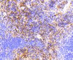 VCAM-1 (CD106) Antibody in Immunohistochemistry (Paraffin) (IHC (P))