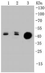 Cytokeratin 20 Antibody in Western Blot (WB)