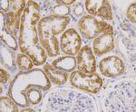 CD9 Antibody in Immunohistochemistry (Paraffin) (IHC (P))