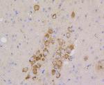 CD9 Antibody in Immunohistochemistry (Paraffin) (IHC (P))