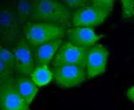 RhoA/RhoB/RhoC Antibody in Immunocytochemistry (ICC/IF)