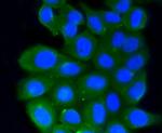 RhoA/RhoB/RhoC Antibody in Immunocytochemistry (ICC/IF)