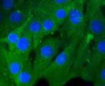 RhoA/RhoB/RhoC Antibody in Immunocytochemistry (ICC/IF)