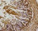 RhoA/RhoB/RhoC Antibody in Immunohistochemistry (Paraffin) (IHC (P))