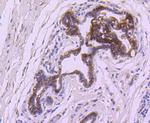 BCL-XL Antibody in Immunohistochemistry (Paraffin) (IHC (P))